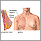 Breast augmentation - series Breast augmentation - series
